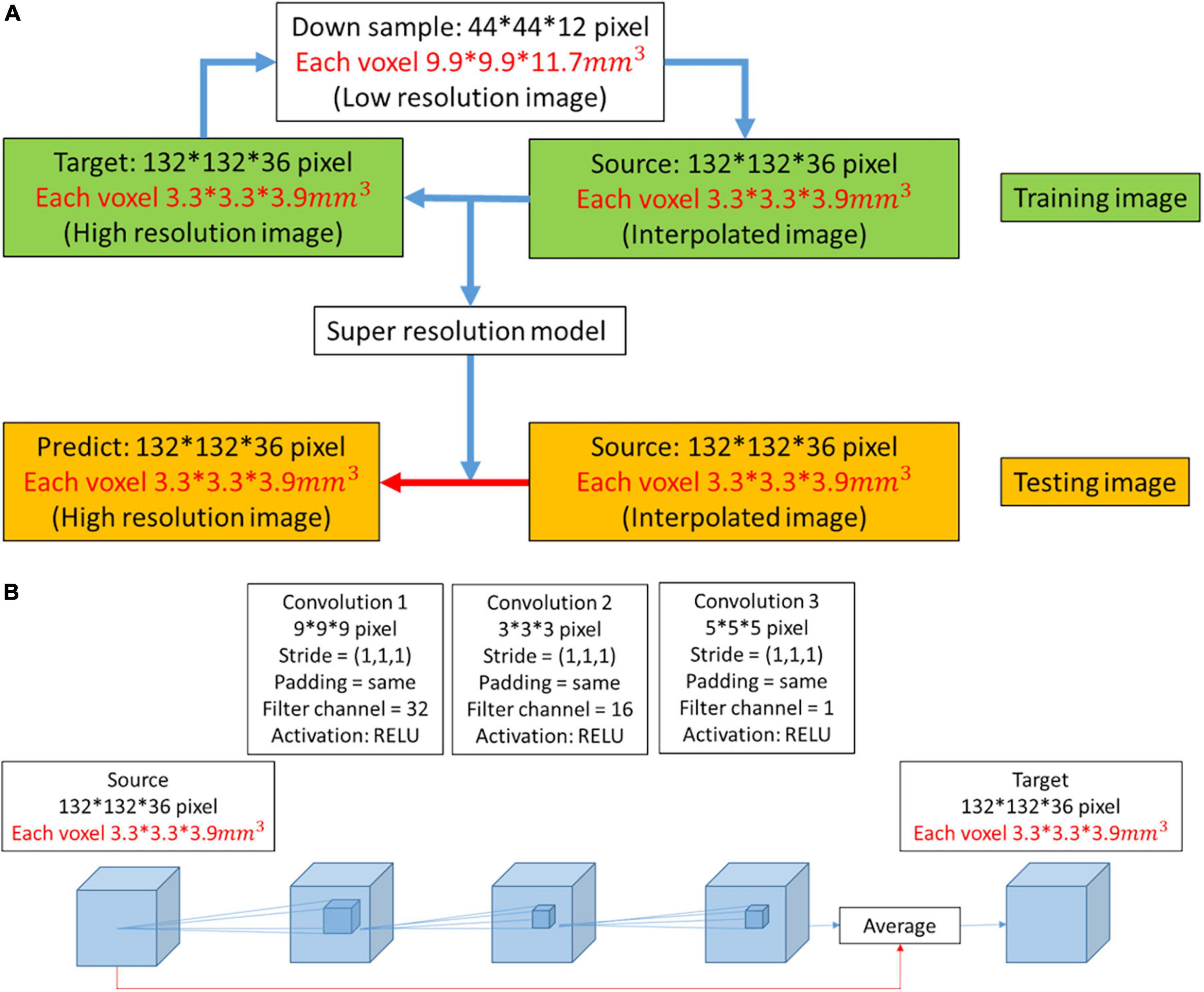 Improving the brain image resolution of generalized q-sampling MRI revealed by a three-dimensional CNN-based method